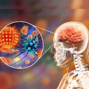 CNS Infections Treatment in Hyderabad - Dr Soumya Reddy Neurologist Hyderabad - CANES Clinic