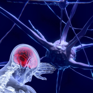 Best Neuropathy Treatment In Hyderabad = Dr Soumya Neurologist - CANES Clinic